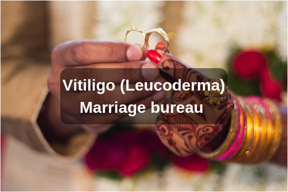Read more about the article Marriage Bureau for People with Vitiligo (Leucoderma)